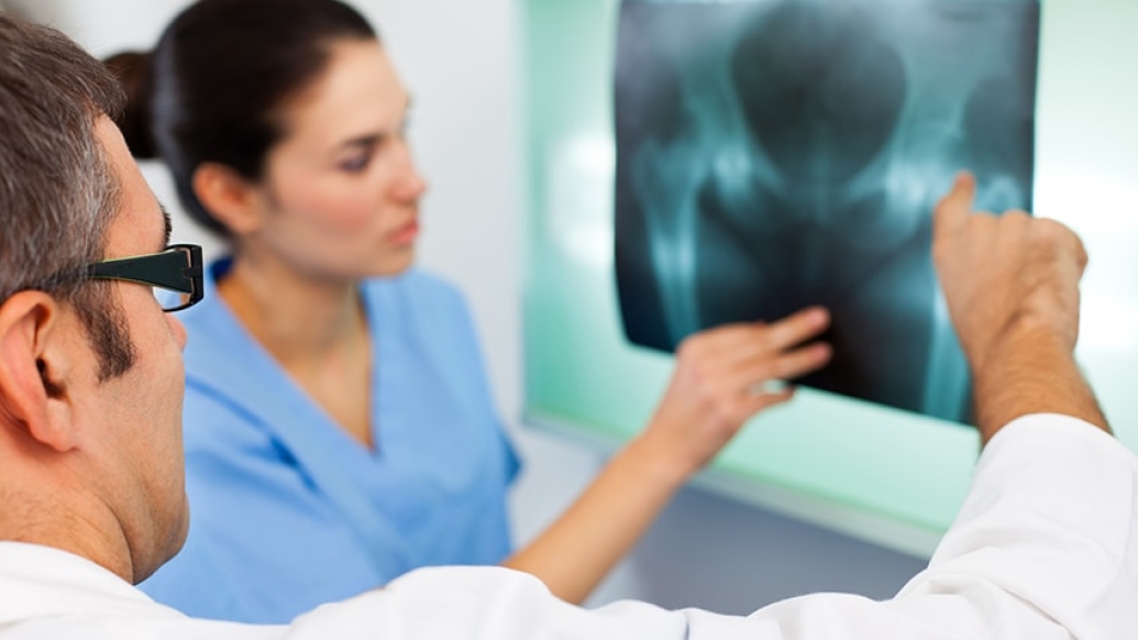 Doctors looking at an x-ray of postmenopausal bone loss