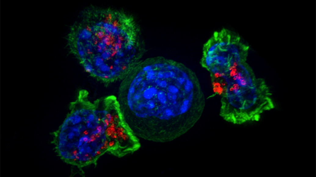 cancer cells microscope blue green