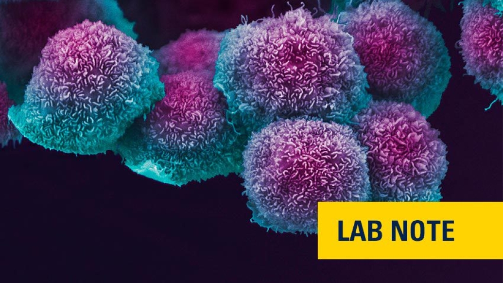purple and blue microscopic cancer cells with lab note badge on bottom right in yellow and navy