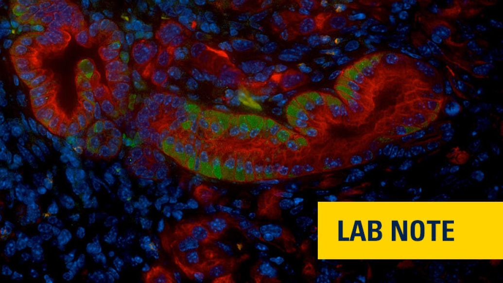 mutlicolored cells merging microscopic blue image with lab note badge in yellow on right