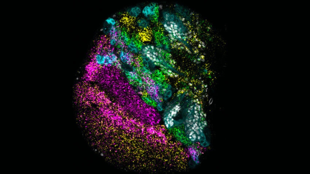 Microscopic image of developing fruit fly brain lobes.