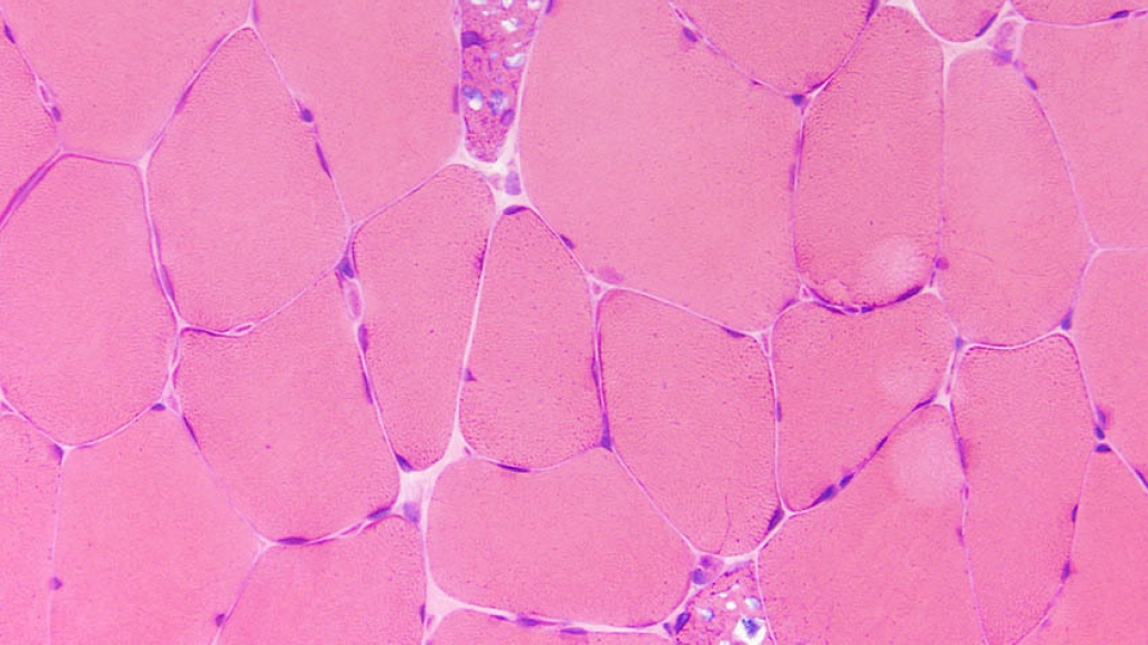 Pink Glycogen under microscope