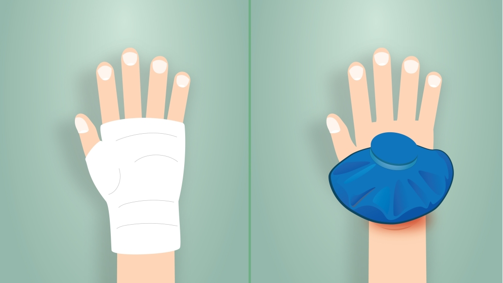 Two different hand injuries requiring acute care