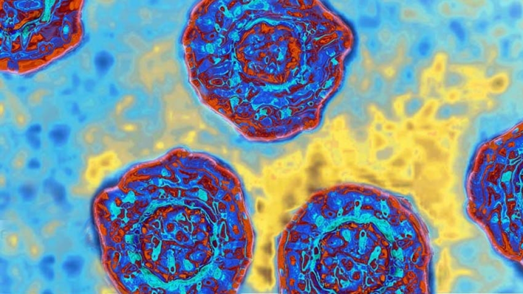 image of purple and blue cells on a blue background with some yellow in background